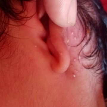 Bun ada yang tau ngga obat ini