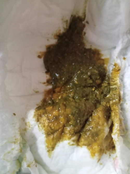 ถ่ายแบบนี้เปนอะไรคะแม่ๆ