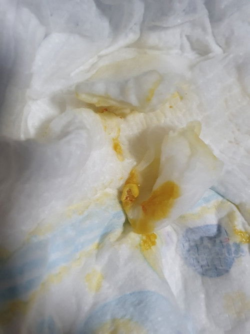 ลูกกินนมผง