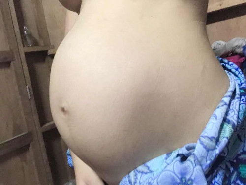 35+2 week สอบถามหน่อยค่ะ