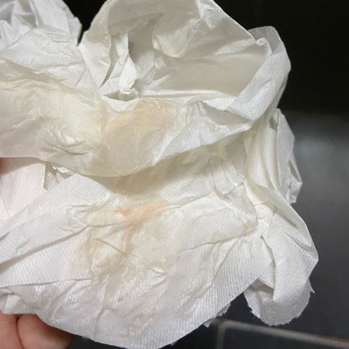 ท้อง27+2วีคมีเลือดติดทิชชูมา