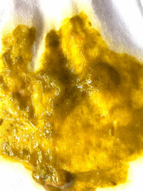 ลูกถ่ายเป็นมูกมีเลือดปน