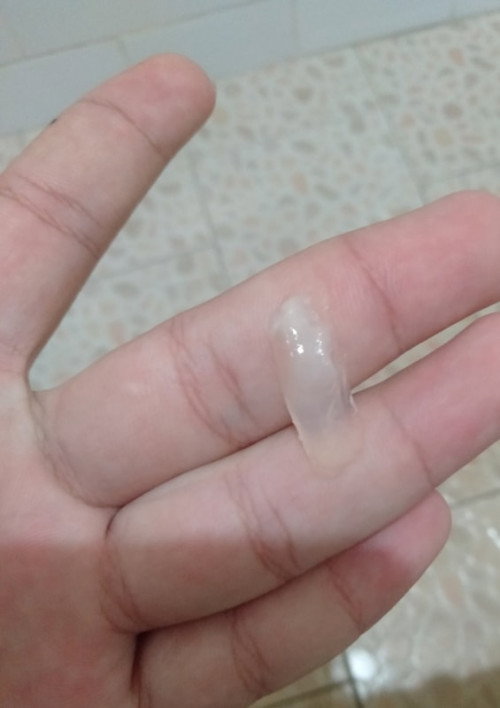 เเบบนี้คือตกขาวใช่ไหม