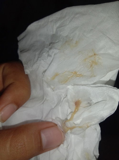 tanda lahiran seperti inikah