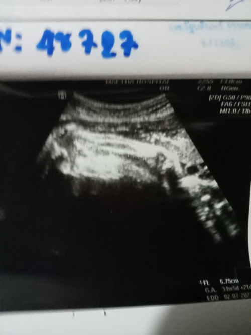 แม่ๆช่วยดูหน่อยค่ะว่าน้องเป็นเพศอะไร