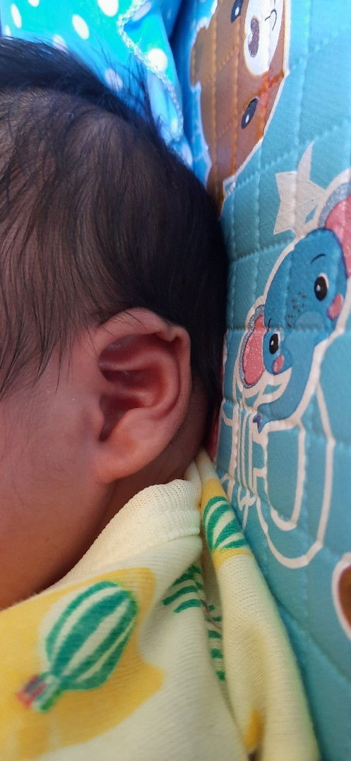 Daun telinga terlipat