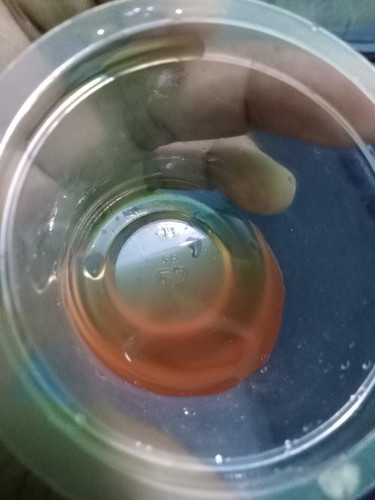 Bun maaf jorok yaa , ko tbtb warna pipis saya ko merah kaya campur darah yaa , kira² bahaya gak sii