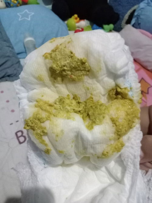 แบบนี้ลูกท้องเสียมั้ยค่ะ