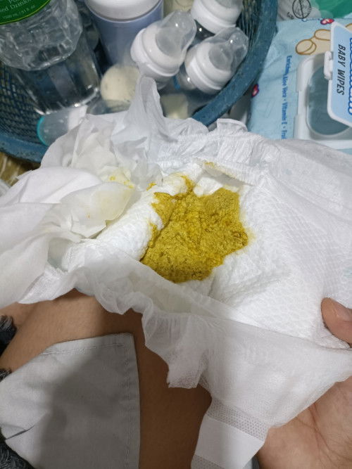 Formula Fed Poop Color and Consistency