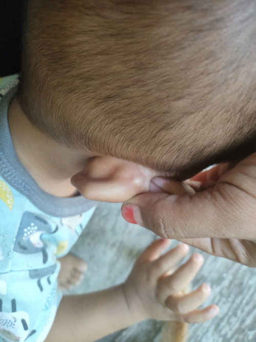 Benjolan di belakang daun telinga