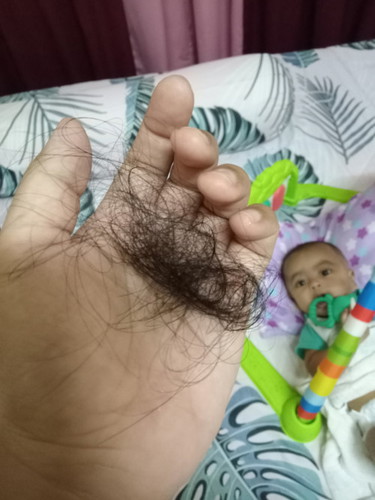 rambut gugur selepas bersalin