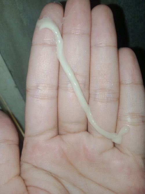 ขออภัยในภาพที่ไม่น่าดูนะคะ
ตกขาวชอบออกมาแบบนี้ปกติไหมคะ เป็นเส้นยาวๆ  ท้องที่2 อายุครรภ์23สัปดาห์4วั