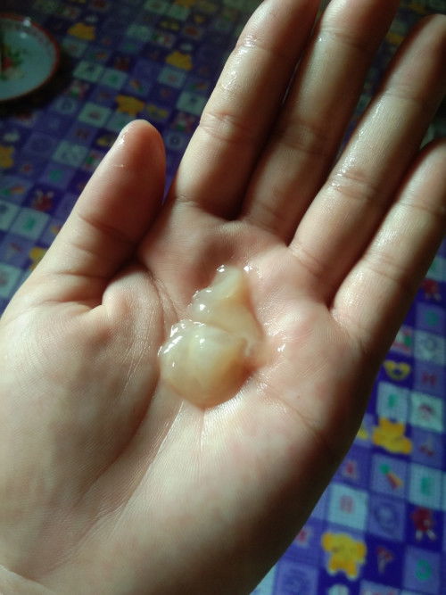 ปากมดลูกเปิด1เซนเมื่อไหร่จะคลอด