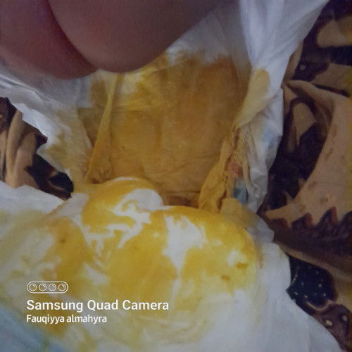 FASES BAYI  3 BULAN LEBIH,CAIR 4 HARI