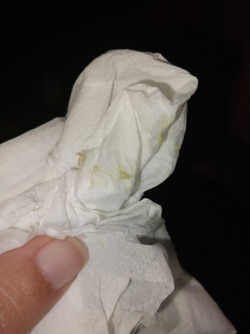 Keputihan gatal dan kuning