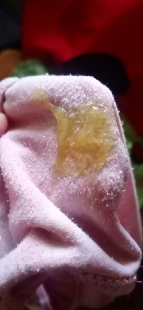 sorry sa picture, mucus plug naba to?  Due date kuna kasi tom.  No sign of labor worry na kasi ako.