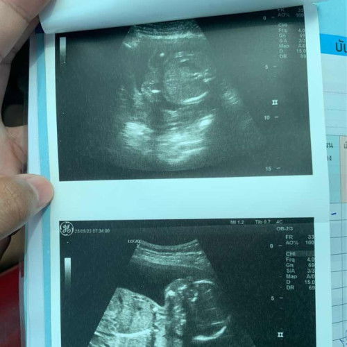 อยากทราบเพศน้อง