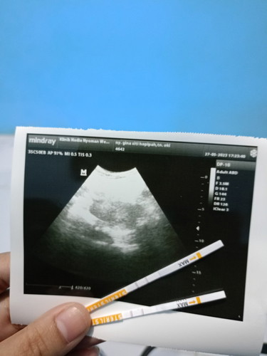 Ada gak yg kyk sya mam udh telat haid 3 hari d tespek garis dua jelas tp pas d USG blm kelihatan