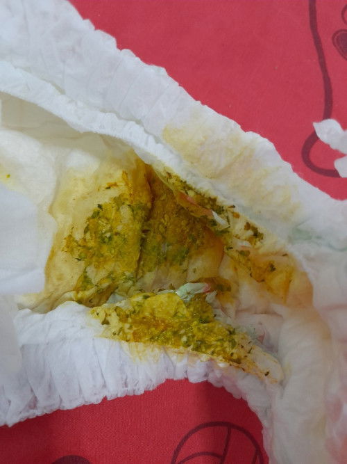 อึน้องสีแบบนี้ปกติไหมคะ