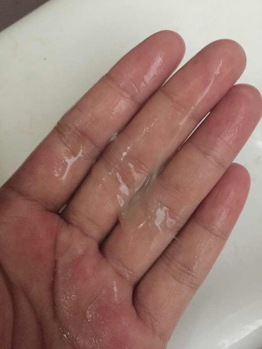 มีมูกใสแบบนี้ควรไปหาหมอมั้ยคะ
