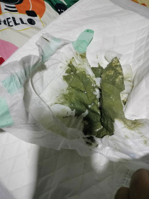 ขี้เทาน้องหมดตอนไหนคะ