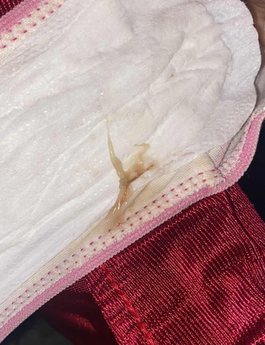 Mucus plug or not?