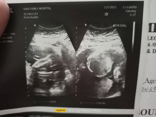 GIRL OR BOY