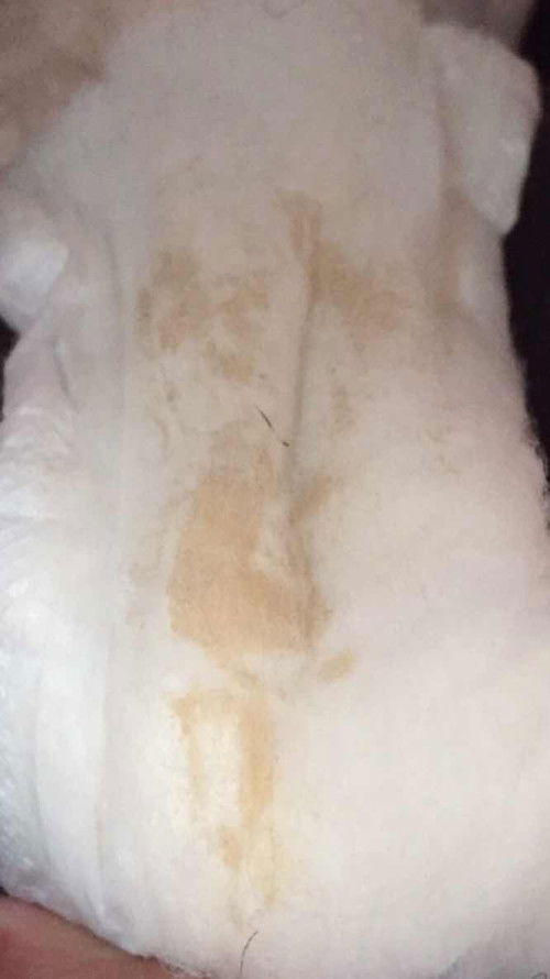 maaf banget bunda2 kl jorok🙏🏻 ini kenapa ya setelah 3minggu keguguran tanpa kuret😥🙏🏻🙏🏻