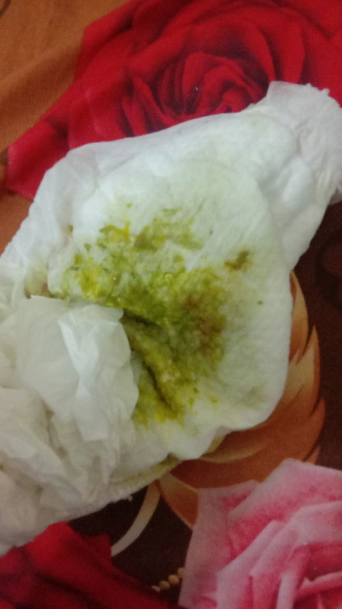 Pup anak berwarna hijau