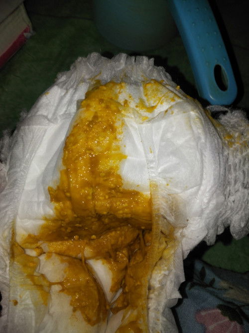 Pup bayi cair maaf gambar sensitif