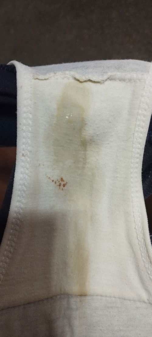 Sino po sa inyo naka experience ng ganitong discharge? Mag 7mos palang po ako nakakapanganak.