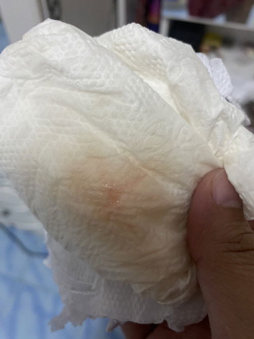 มีมูกเลือด 38w6d