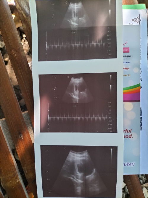 Tinatanggap po ba ng sss ang pic ng ultrasound kahit walang nakaattach na pangalan?