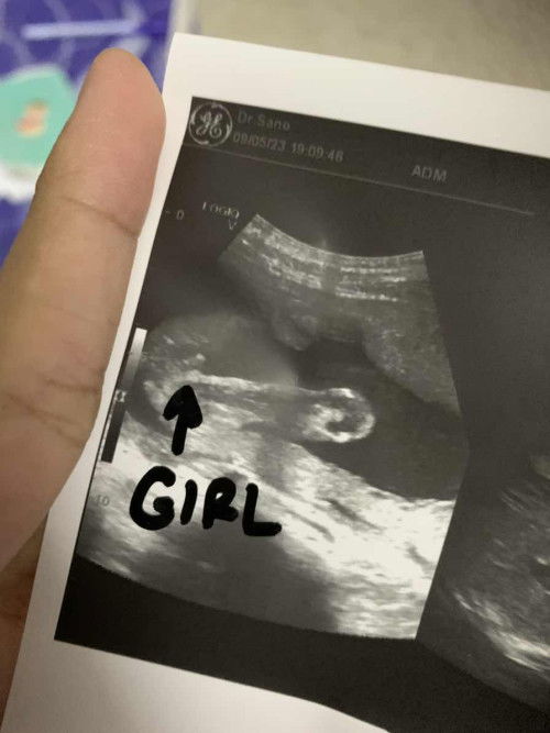 ช่วยดูให้หน่อยได้ไหมคะ