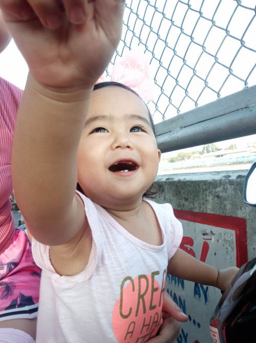 Hiwa-hiwalay ang tubo ng ngipin ni baby