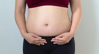 Stretchmark di usia 36 minggu
