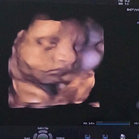 ทีมกรกฎาคม66