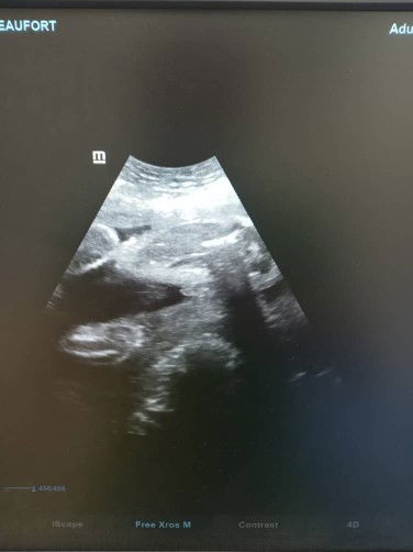 Jantina boy atau girl?