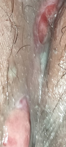 hello mga mi ask ko lng po