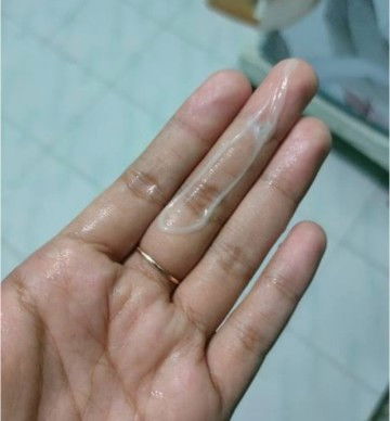 Keputihan saat hamil