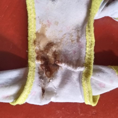 Ano po ibig sabihin ng ganitong discharge?