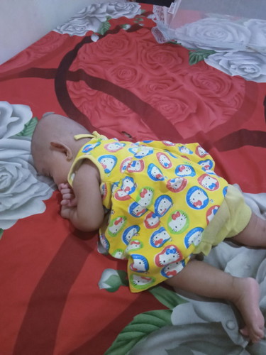 Bun ada yg sama gak anak 3 bulan 10 hri tpi blm bisa angkat kepalah kalau mau tengkurap