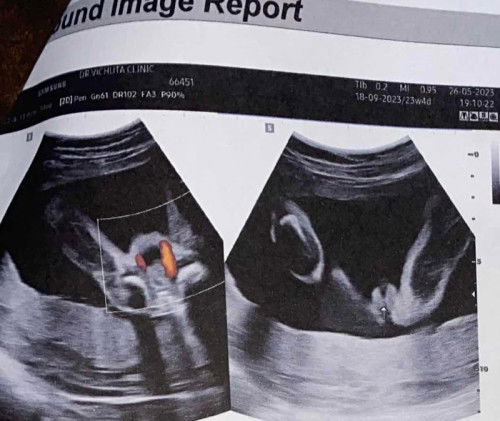 คุณเเม่ได้เพศไหนบ้างค่ะ