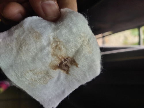 Keluar flek kecoklatan+darah dikit
