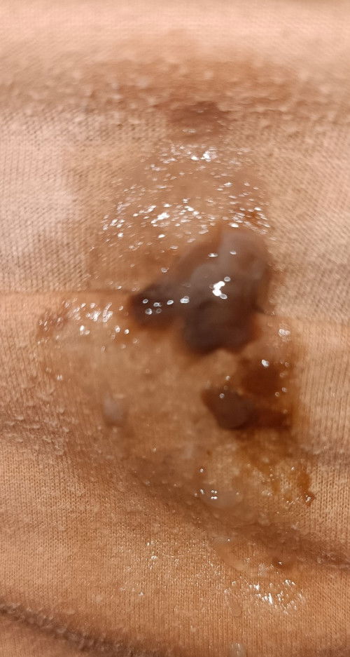 mucus plug?