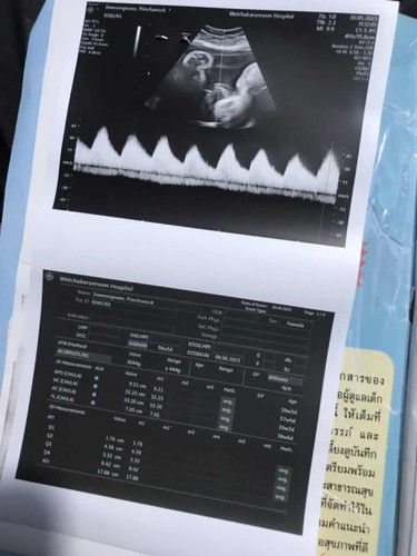 อายุครรภ์ 36+2
