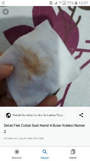 Bun aku mau tanya, flek -+ kya gini bahaya g bun, flek hbis hb, kluar gni. soalnya biasanya gaprnh๐