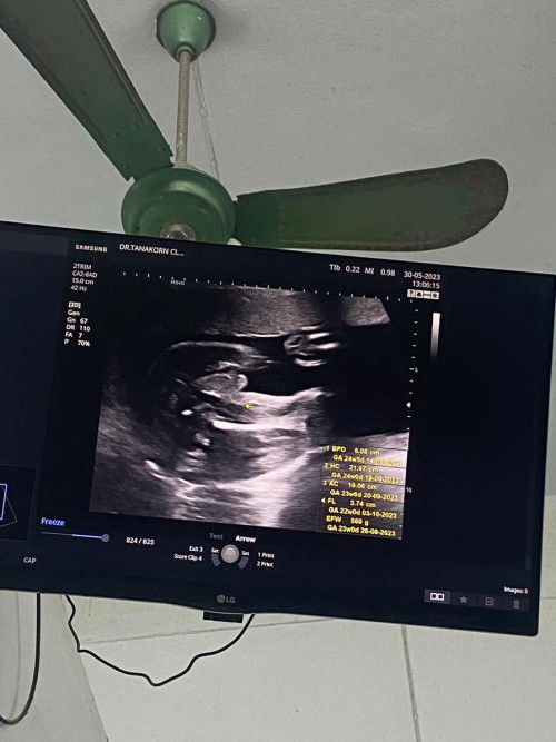 ช่วยดูเพศหน่อยค่ะ😆