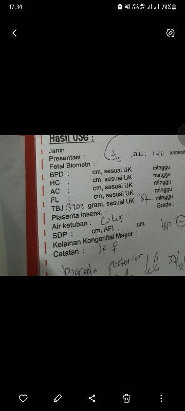 37 weeks BBJ 3202 gr,perkiraan HPL bbj 3.6 kg,kira² normal beresiko ga bund