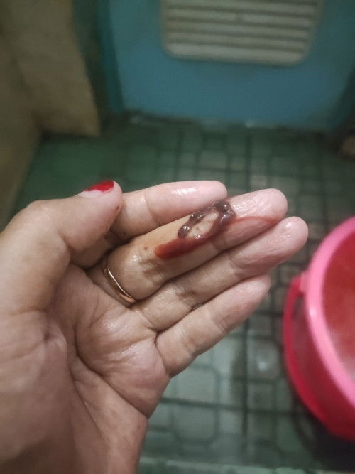 bun mau tanya.. aku kan lagi telat haid  tapi kok tiba"keluar flek gtu ya... kira"itu kenepa ya🥺